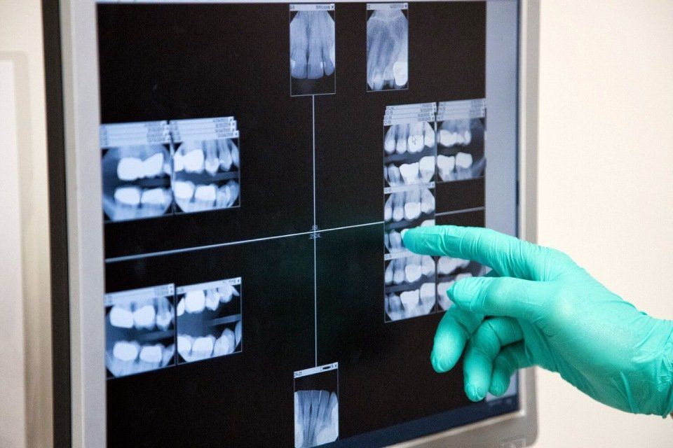 radiografie dentali