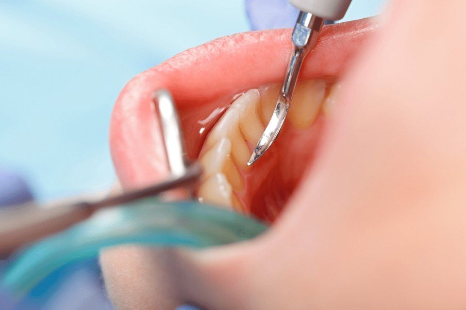 visita di controllo dentale