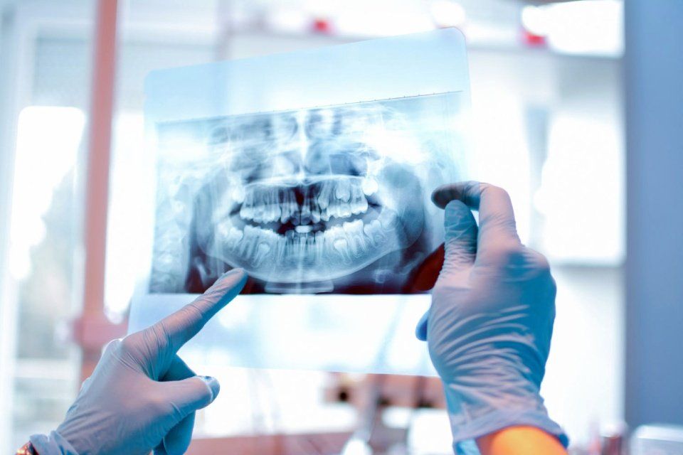 radiografie