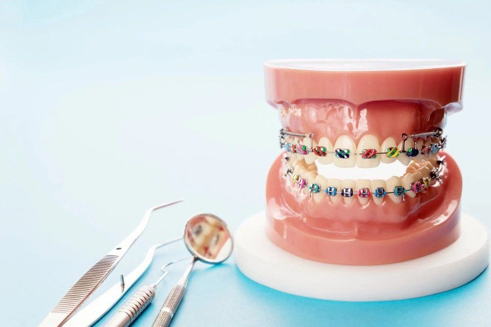 apparecchio dentale fisso