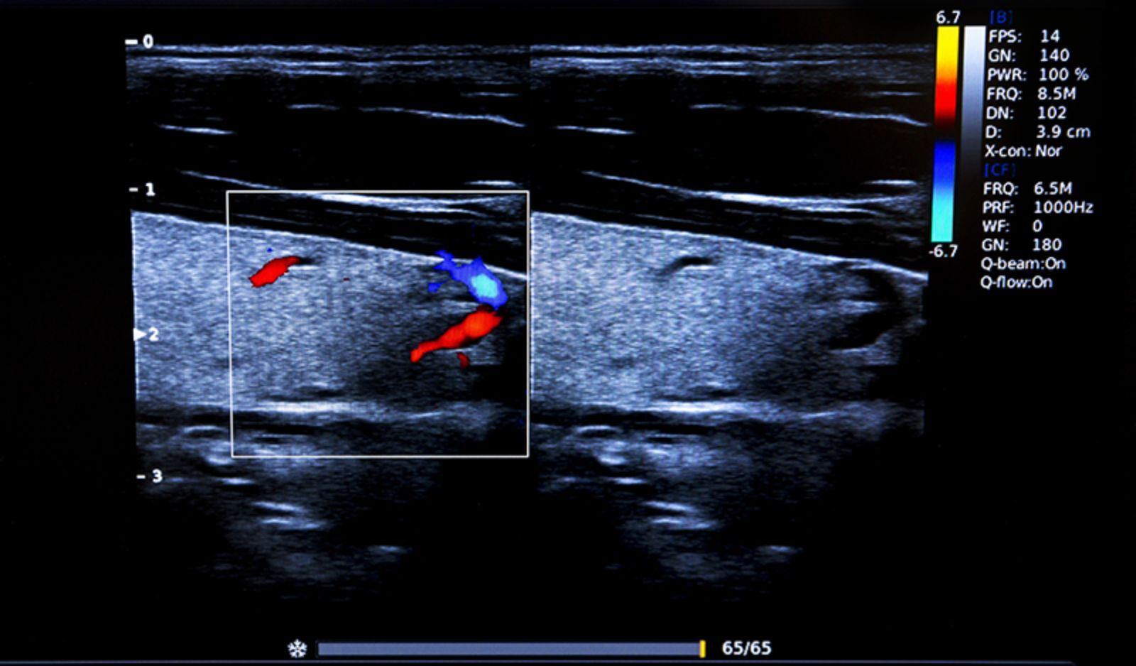 ecocolordoppler