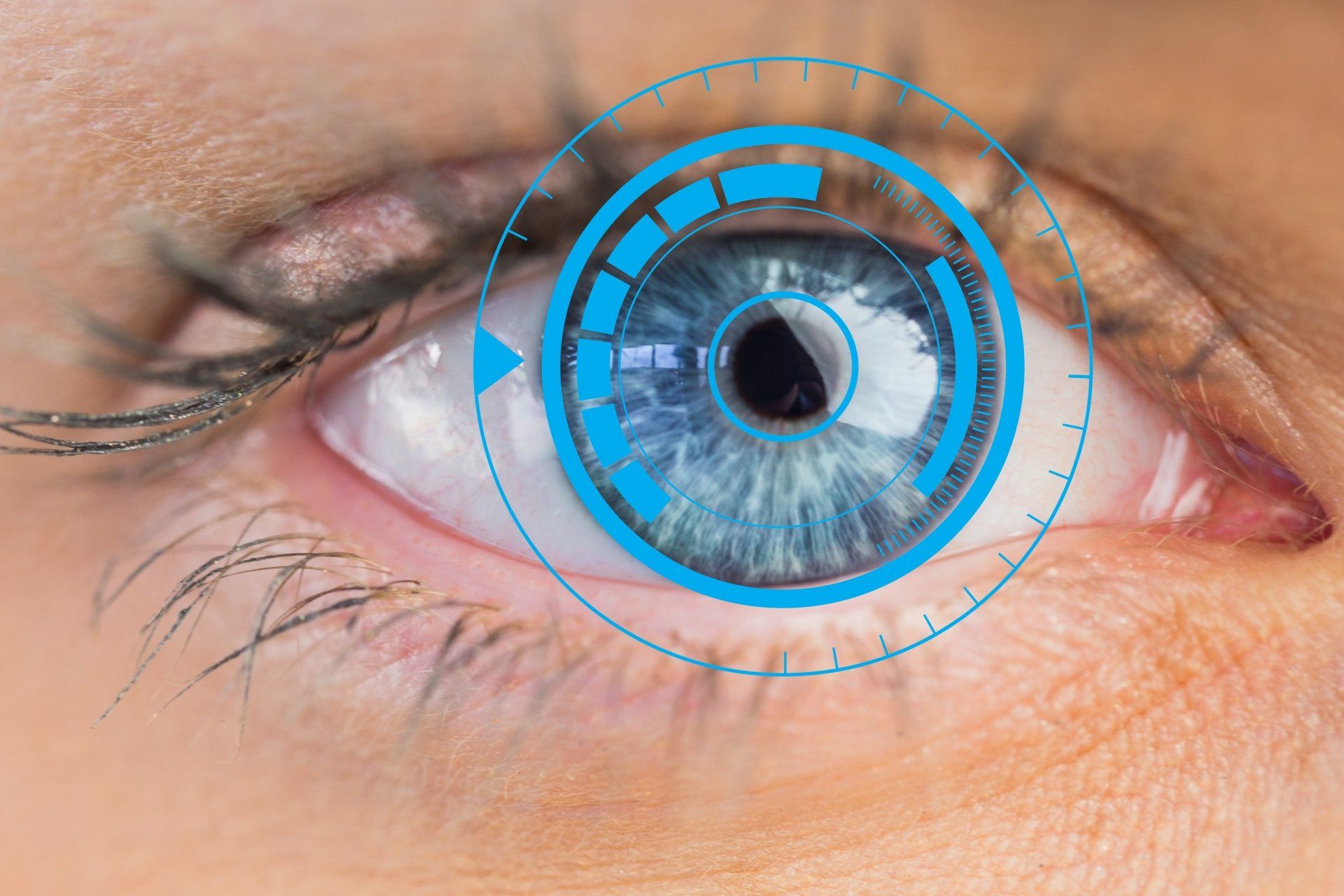 Mapeamento de retina em Jundiaí