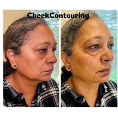 Medical Aesthetics & Wellness | Paired Precision Health & Aesthetics ...
