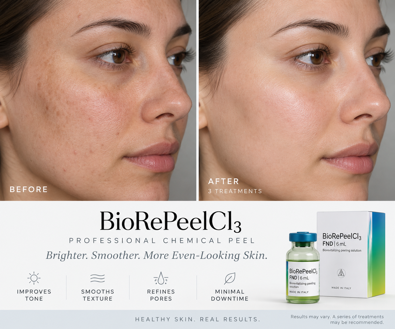 Mother’s Day gift ad for Botox with floral border, treatment photo, and $9.50/unit offer