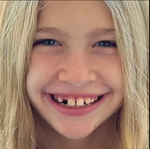 Invisalign Rockford