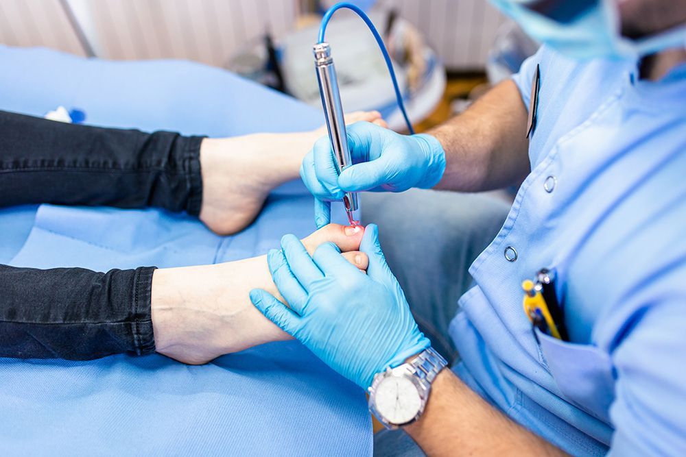 Laser Treatment for Toenail Fungus