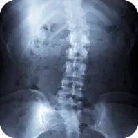 An x-ray of a person 's stomach and spine.