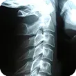 A close up of an x-ray of a person 's spine. A close up of an x-ray of a person 's spine.