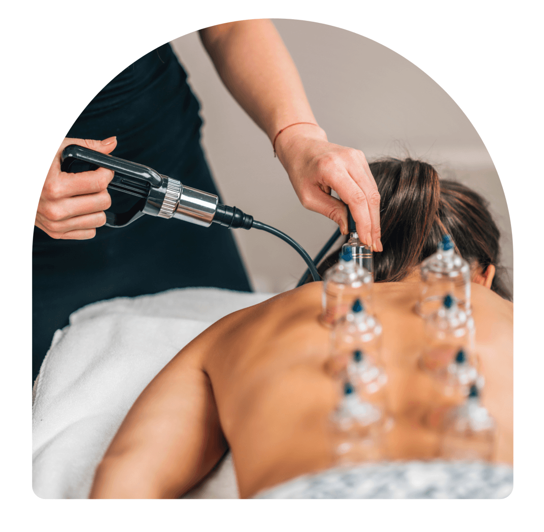 Cupping, San Diego Massage therapist