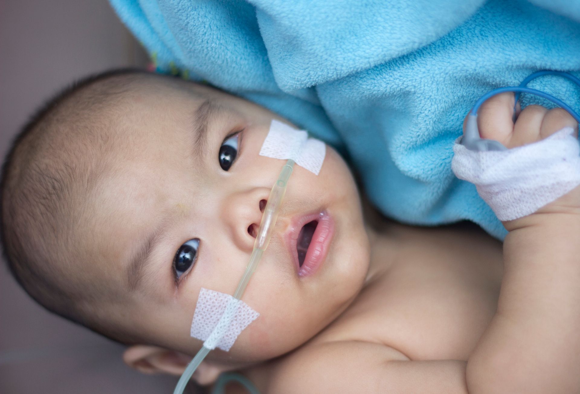 A baby is laying on a bed with an oxygen tube in his nose.