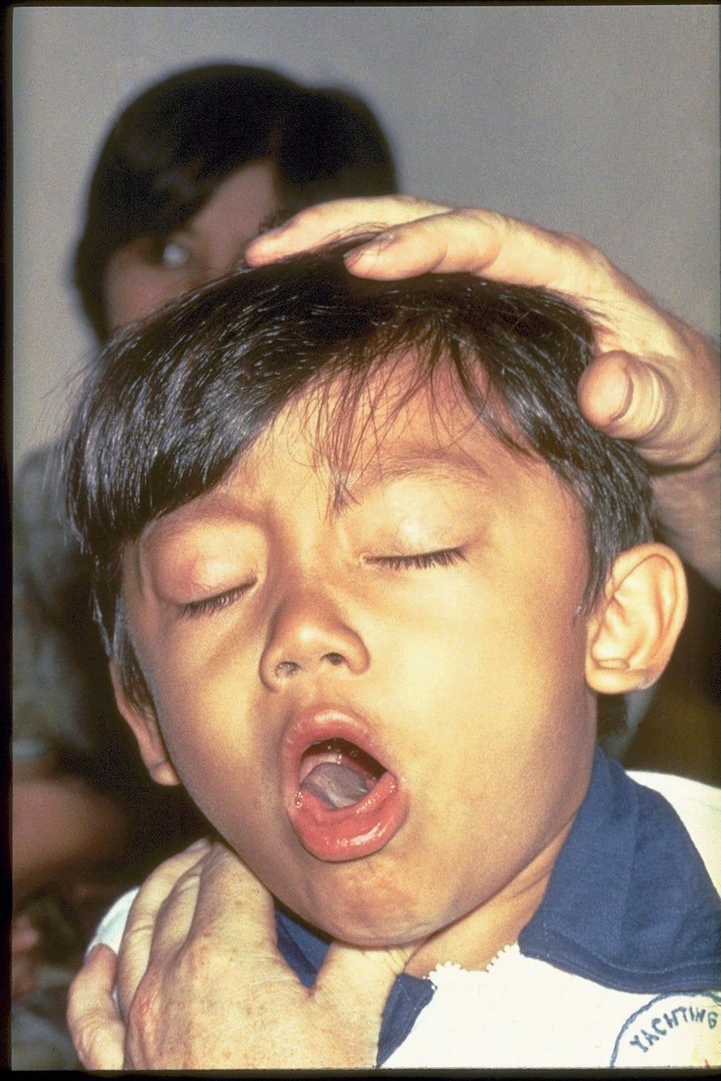 Child with eyes closed and mouth open while someone holds their head from behind