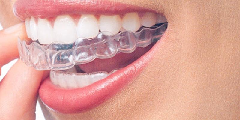 Dentist in Chester, VA: A person putting in Invisalign, a specialty of our dentist office