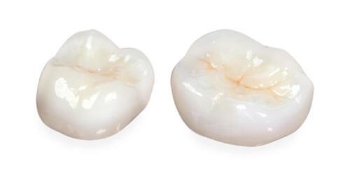 Dentist in Chester, VA: Porcelain dental crowns, a service our dentist office provides