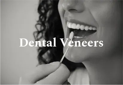Person's mouth with dental veneers, being inspected by a dental instrument. Black and white.