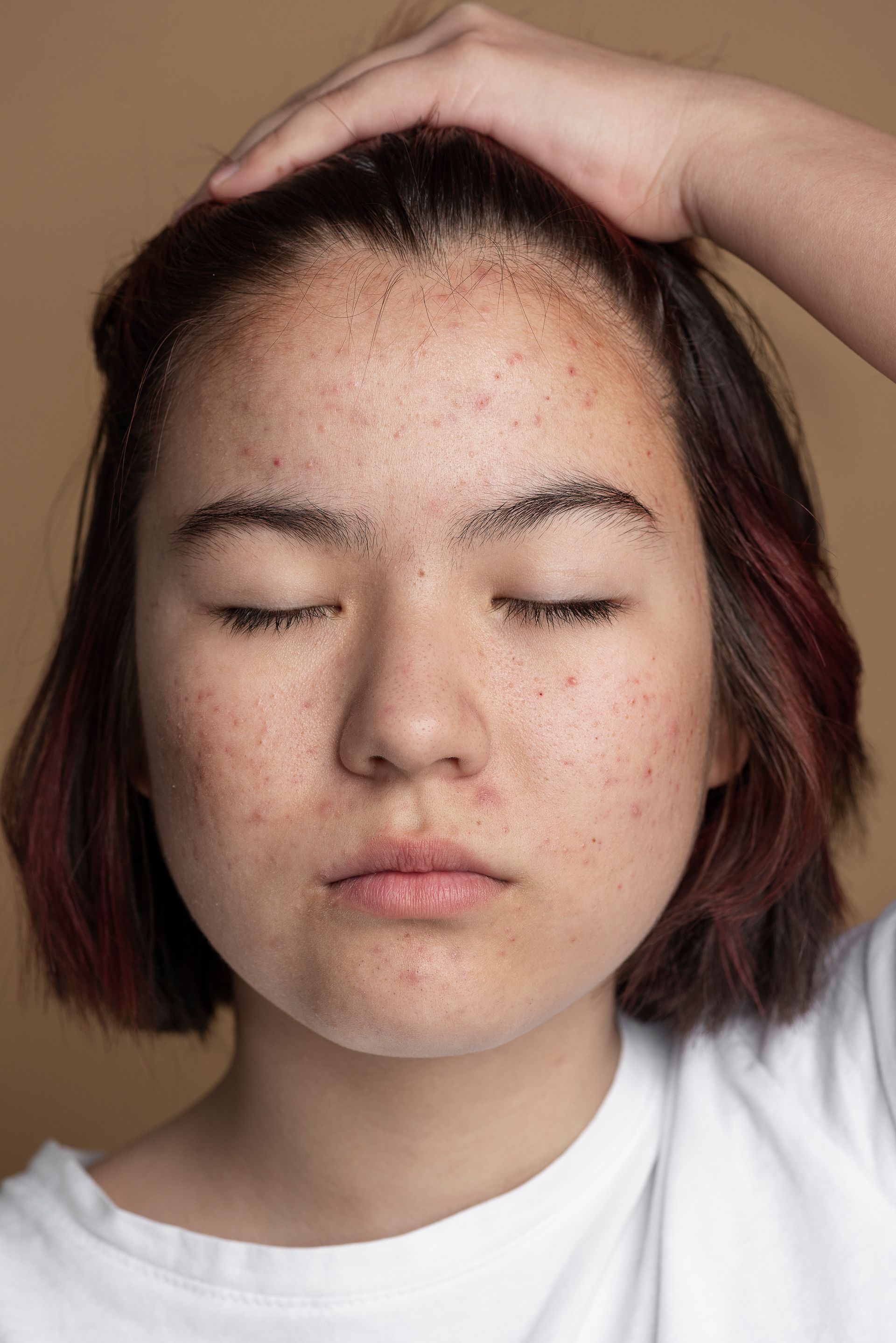 Person with closed eyes, hand on head; light skin, freckles, brown eyebrows, peach background.
