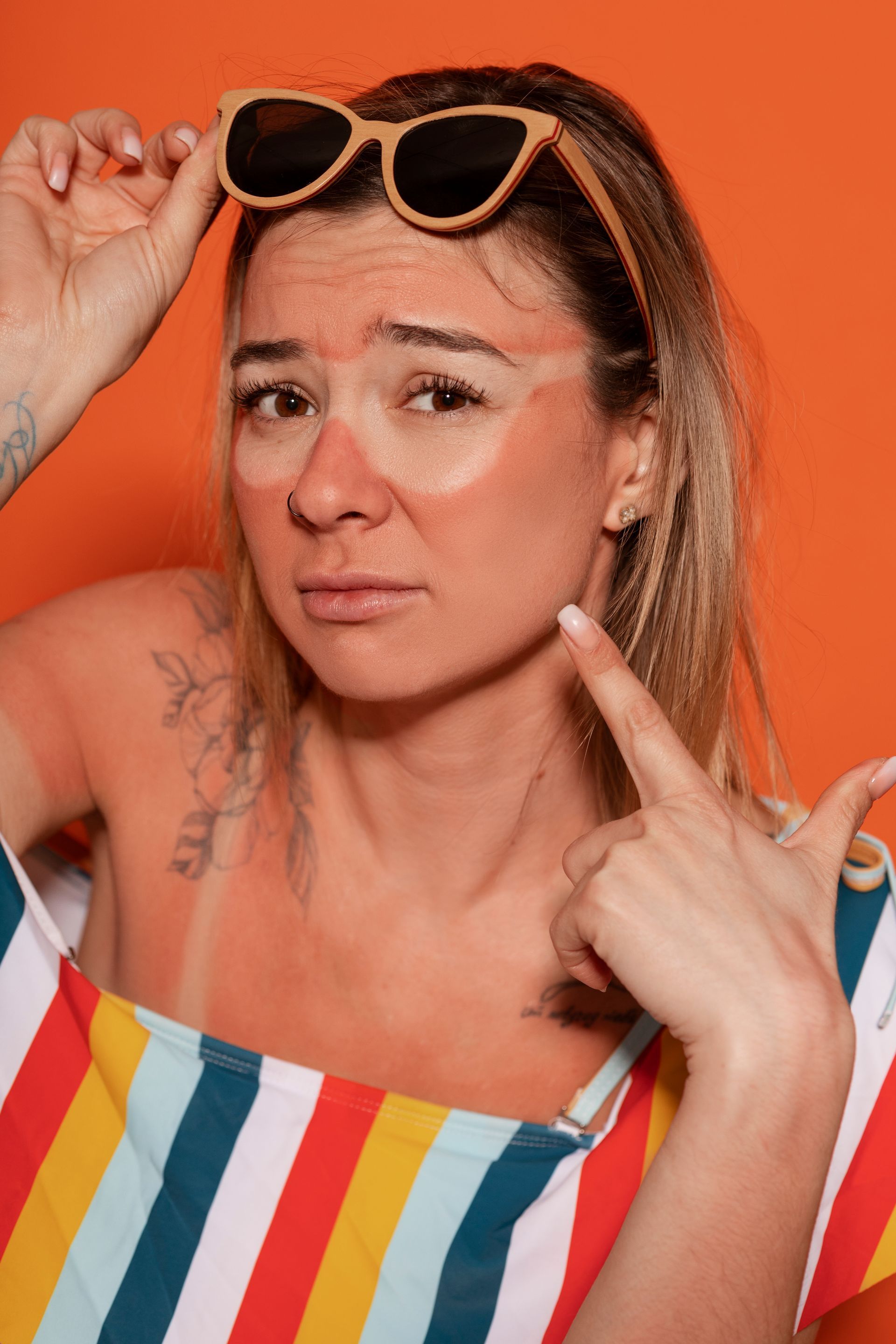 Woman with sunburned face and arms, wearing sunglasses, pointing at face, orange background.