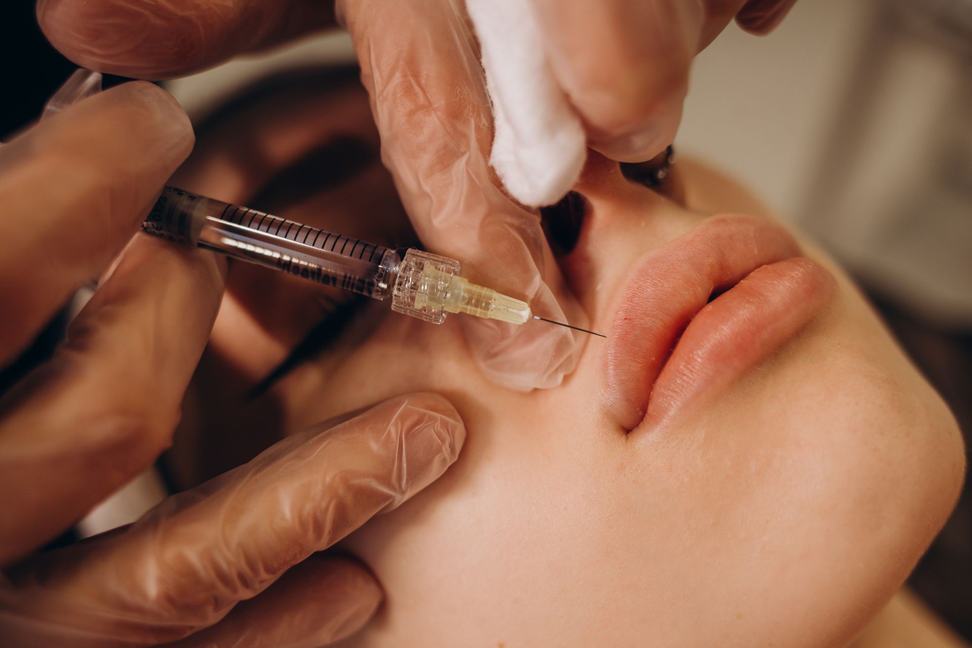 Lip injection procedure: gloved hands injecting a syringe into a person's lip, close-up.