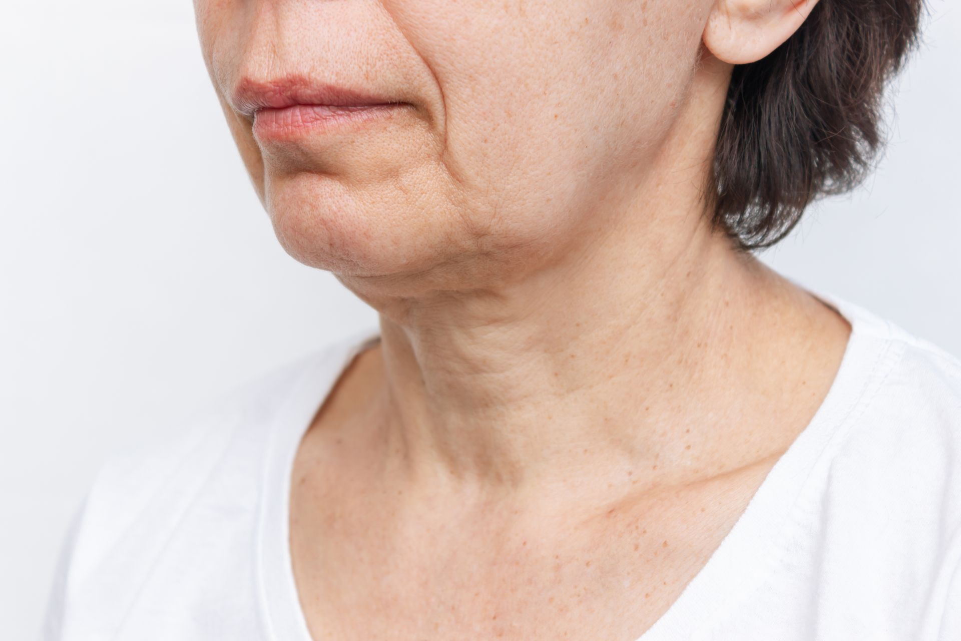 Close-up of a person's neck and chin, showing wrinkles and skin aging; wearing a white shirt.