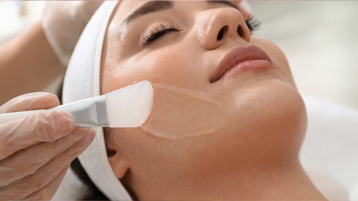 Chemical peel skin treatment Roseville CA