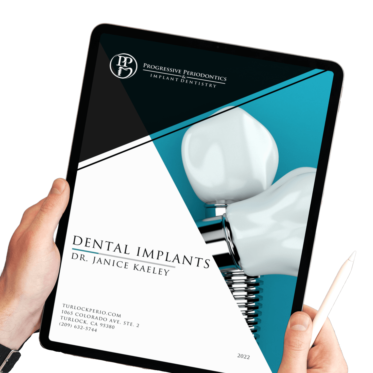 Top Periodontist in Turlock CA 95380 Dental Implants