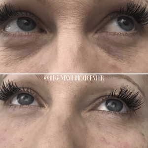 Close-up of eyes before and after mascara, showing longer lashes on the lower image.