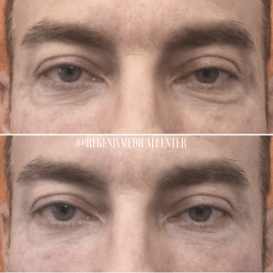 Close-up of two nearly identical eye photos stacked vertically, separated by a thin line with small text.