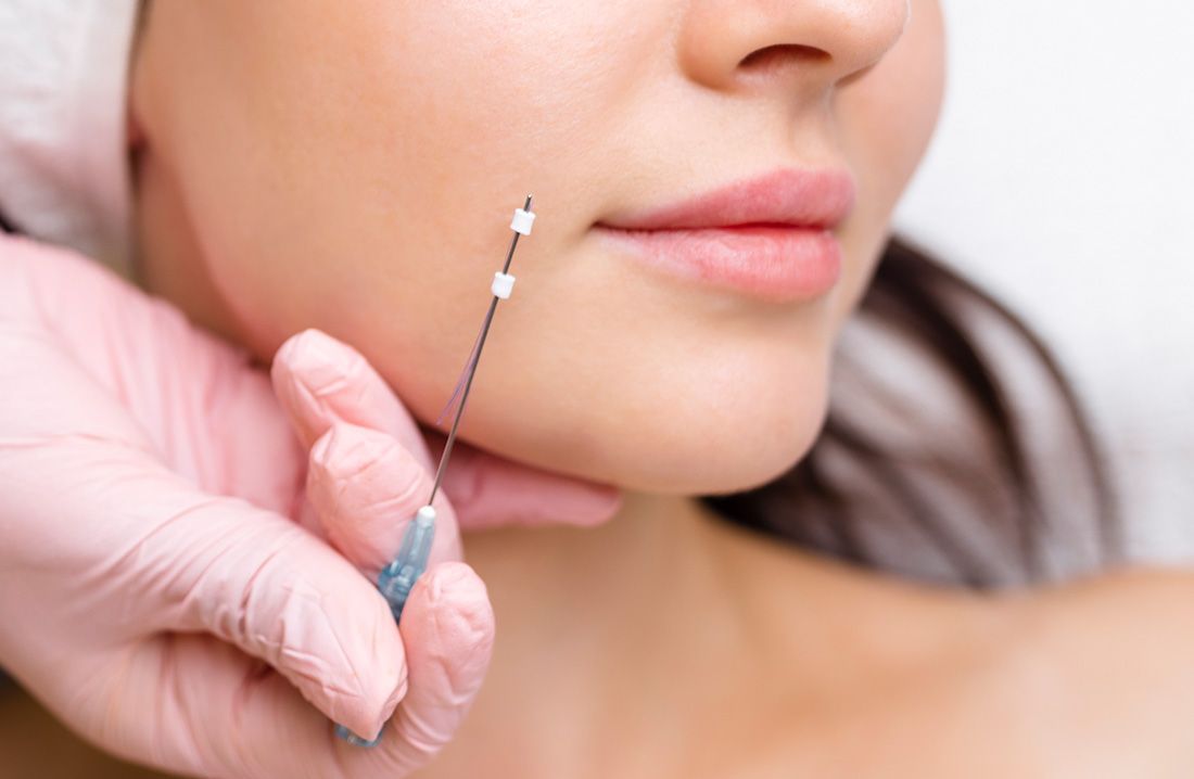 Dermal Fillers Scottsdale
