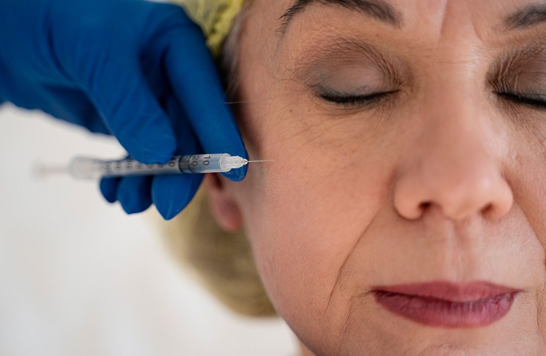 Dermal Fillers Scottsdale