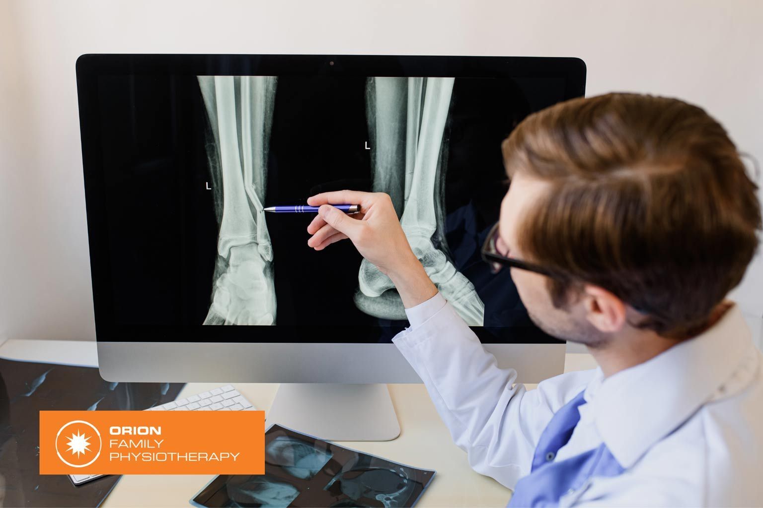 Fibula Fractures