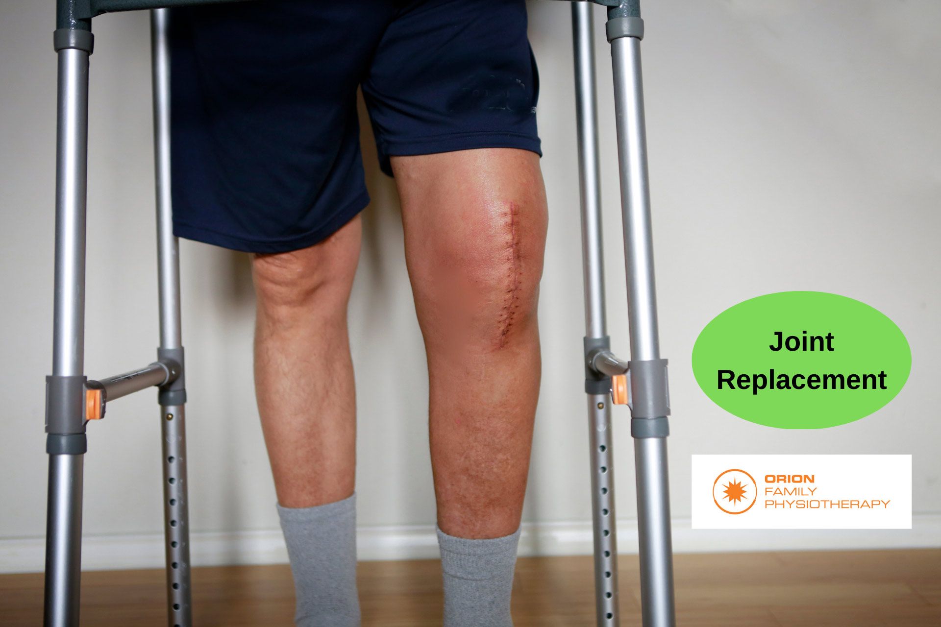 Joint Replacement