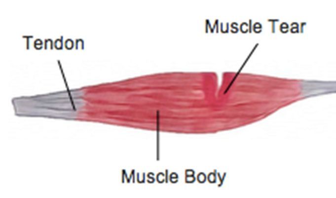 Injury Healing Illustration 