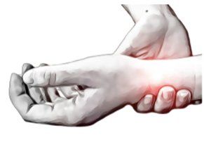 A Wrist Injury: Scaphoid Fractures 2
