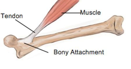 A diagram of a bone with a tendon and muscle attached to it - Springfield Central, QLD - Orion Family Physiotherapy A diagram of a bone with a tendon and muscle attached to it - Springfield Central, QLD - Orion Family Physiotherapy