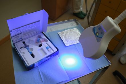strumenti sbiancamento denti