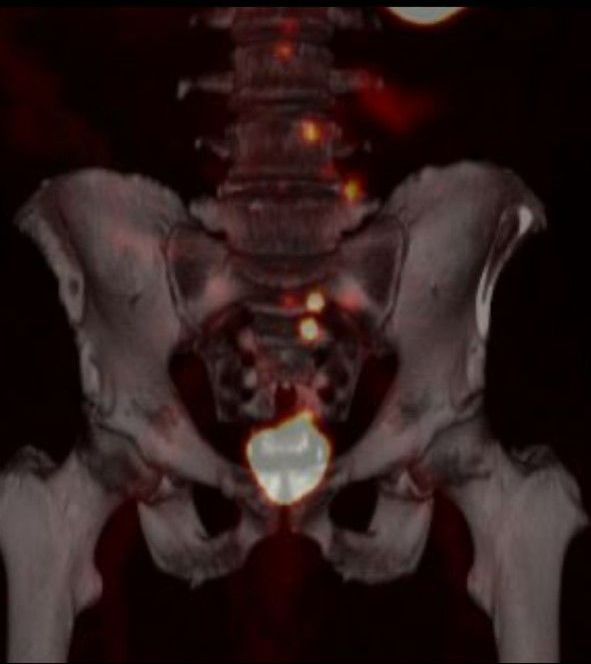 Diagnostic CT — Miami, Fl — CIRA