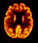 NEUROLOGY — Miami, Fl — CIRA
