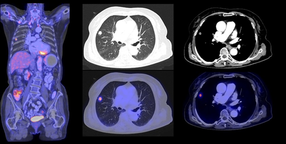 Diagnostic CT — Miami, Fl — CIRA