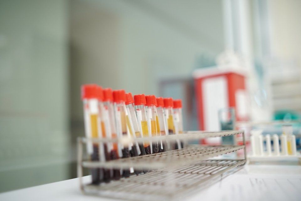 Analisi di laboratorio