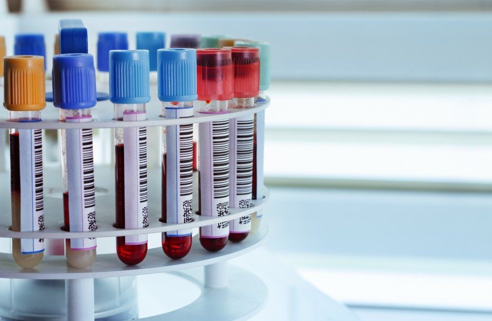 Analisi di laboratorio
