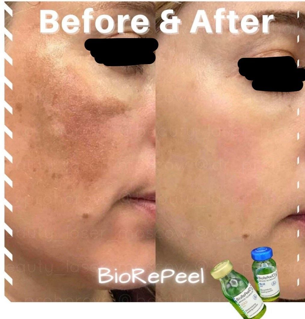 A before and after photo of a woman 's face