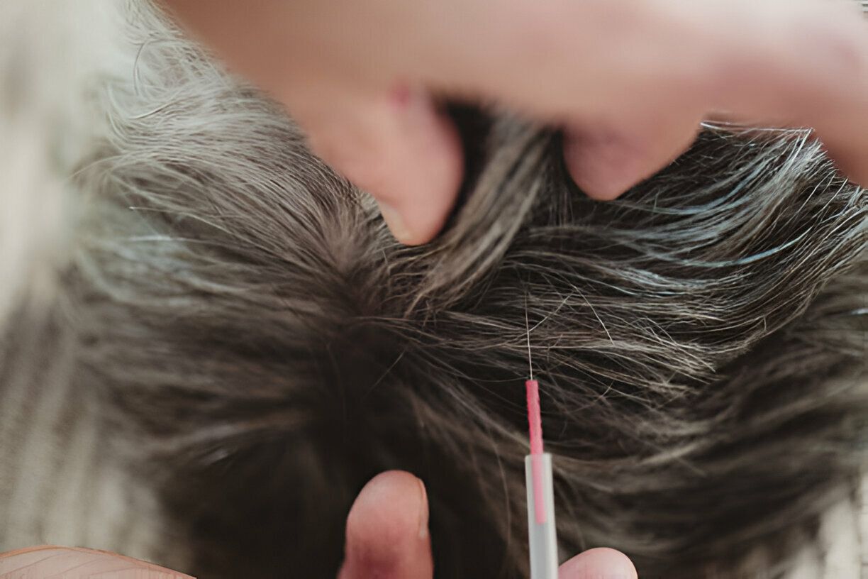 Hands part gray hair with a comb, exposing the scalp.