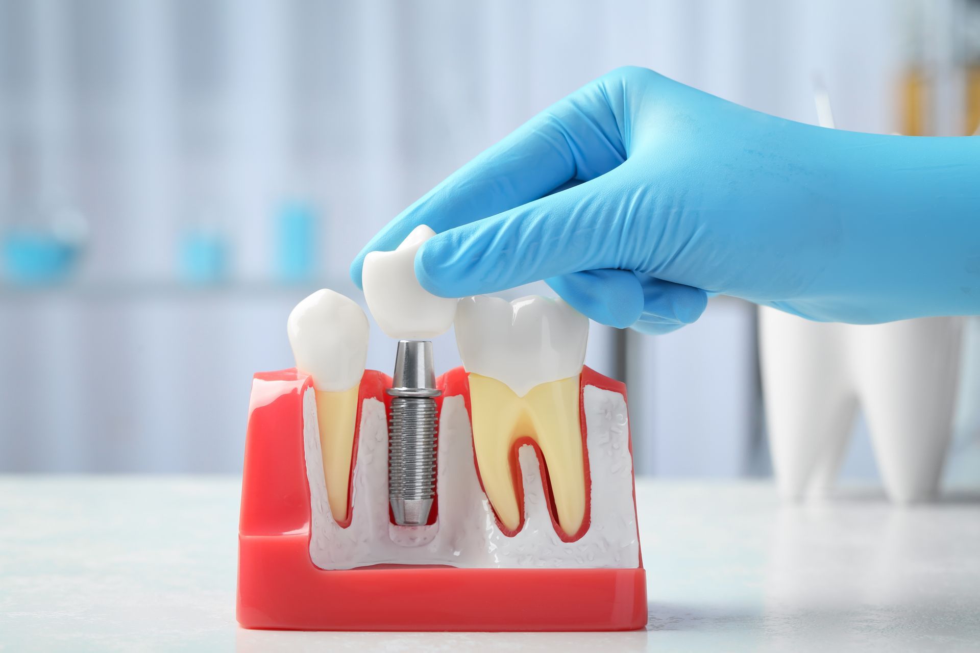 Close-up model showing a dental implant with crown placed into the jaw