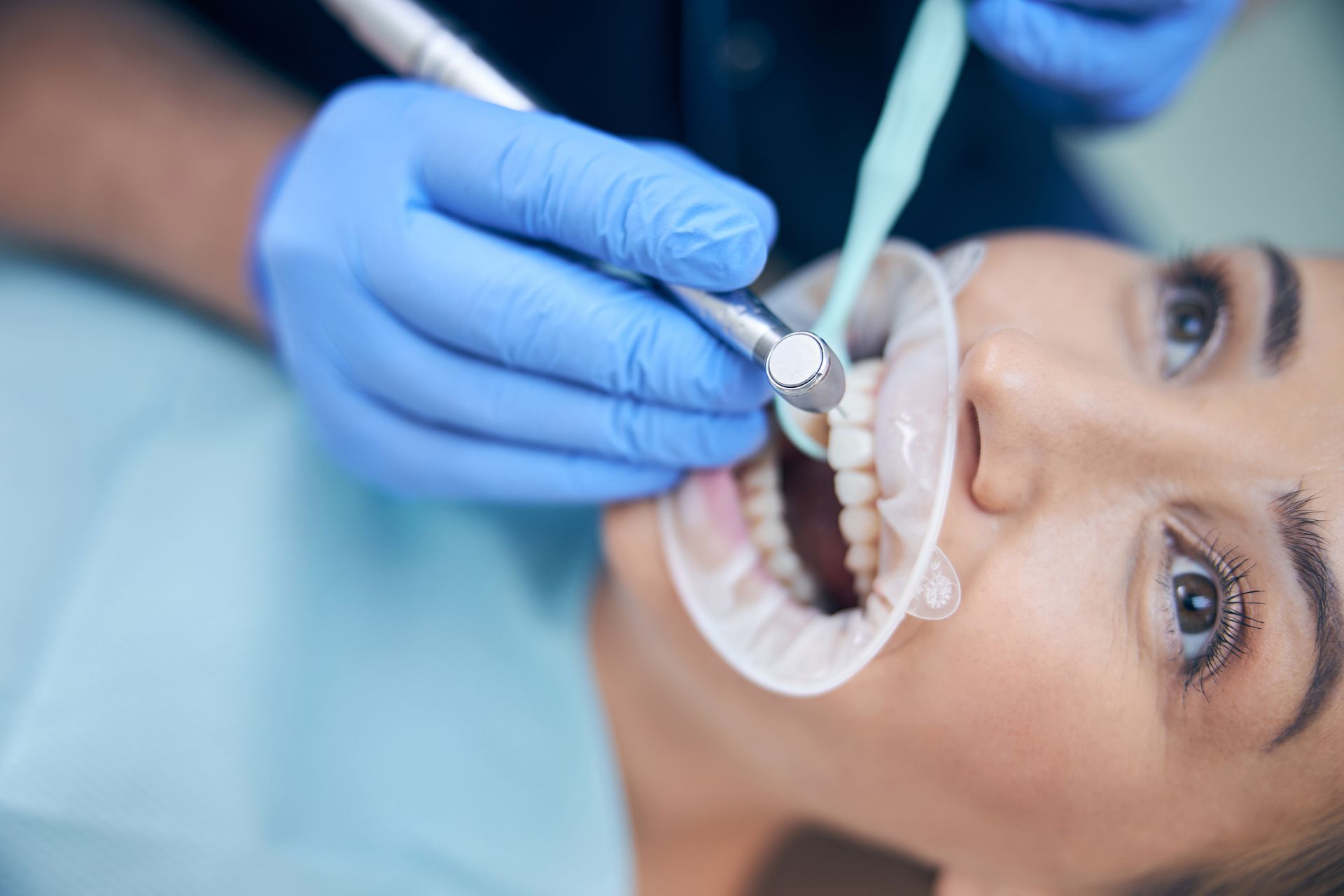 dentist treating young beautiful female in office for wisdom tooth removal