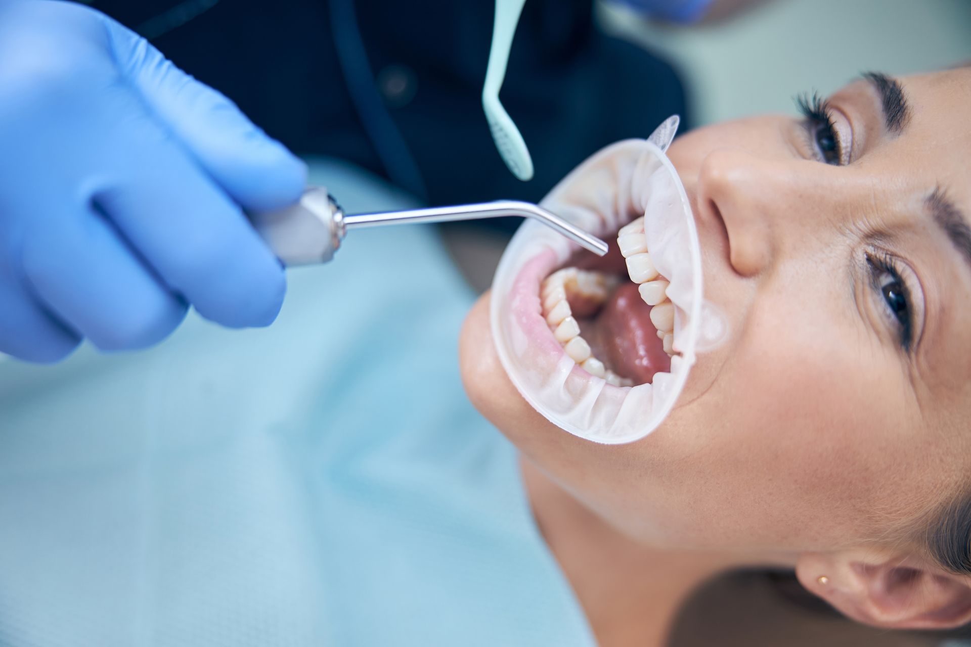 Young woman having teeth filled with dental filling