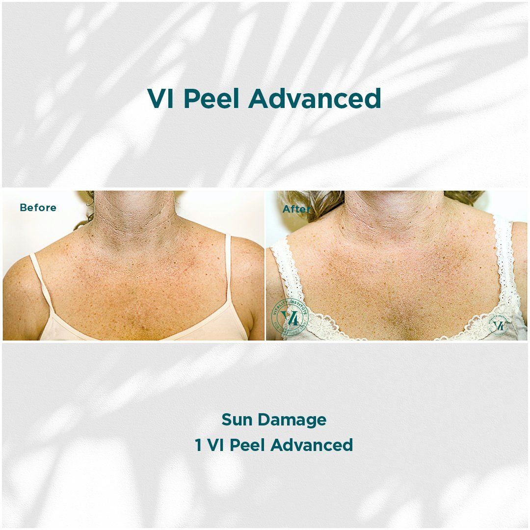 vitamin b12 semaglutide Compounded Semaglutide+B12 vitamin b12 semaglutide Compounded Semaglutide+B12