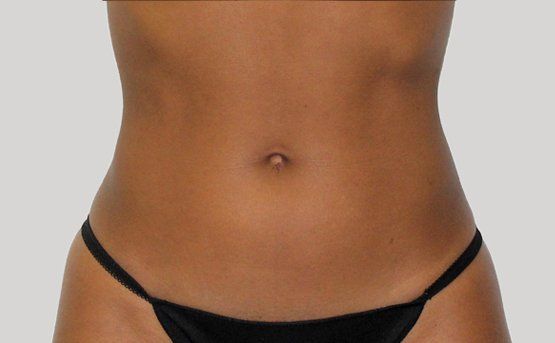 Close-up of a person's brown torso with a visible navel, wearing a black string bikini.