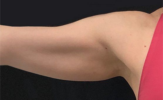 A person's arm, flesh-toned skin, raised against a black background, wearing a pink garment.