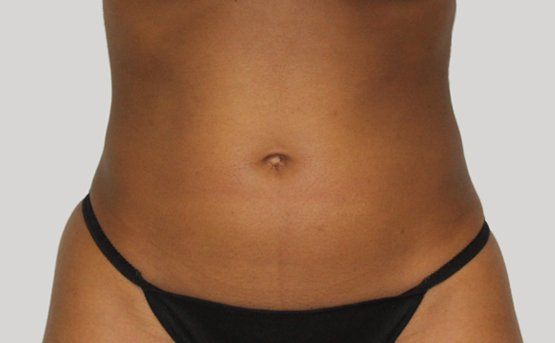 Close-up of a person's midsection; dark skin, wearing a black thong, neutral background.