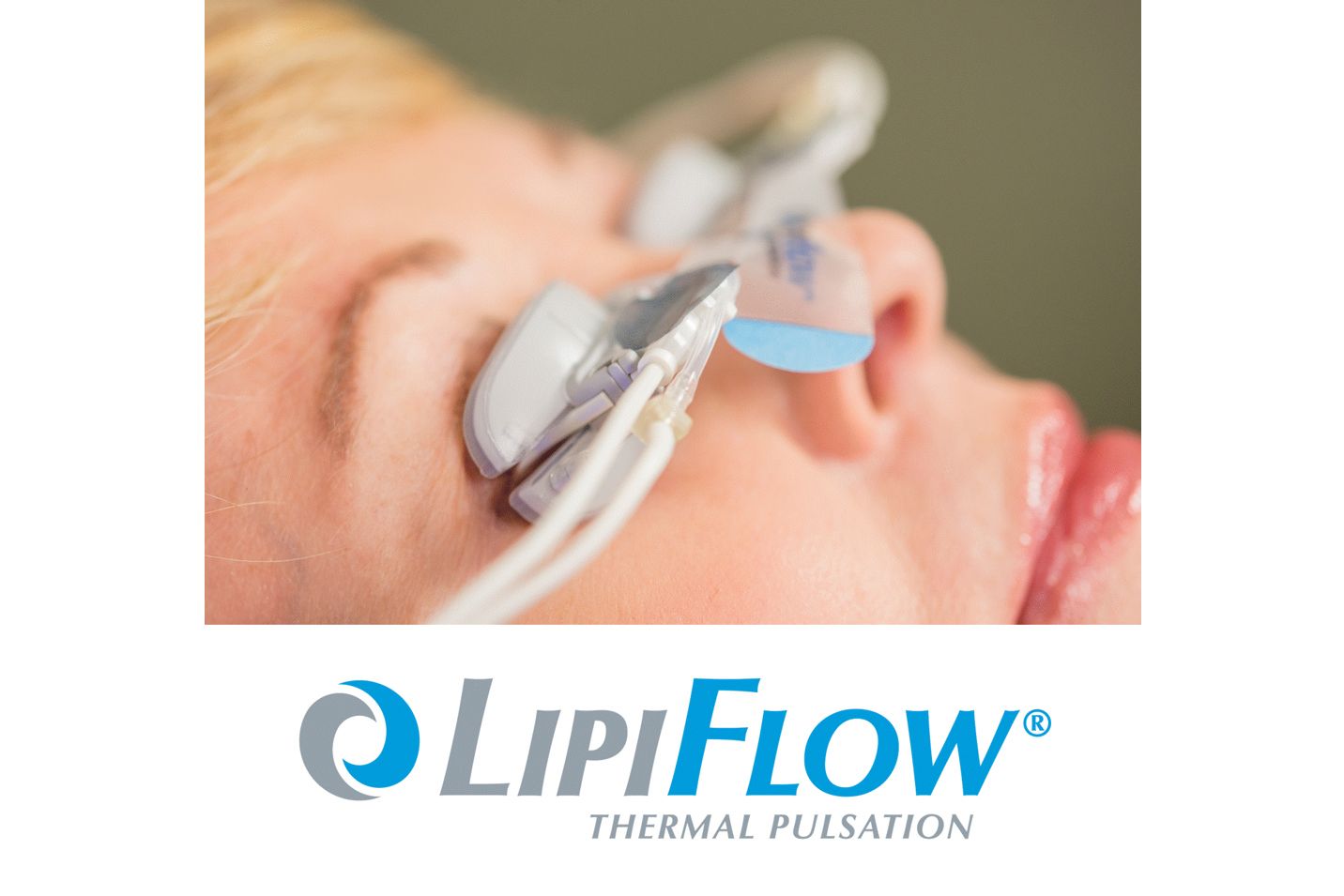 Dry Eye Care Treatment