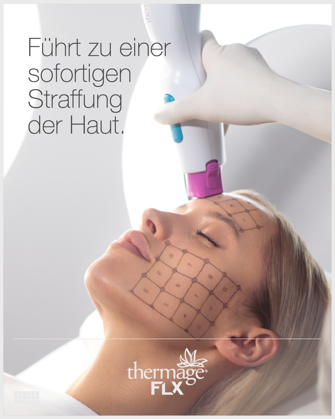 Thermage FLX Behandlung